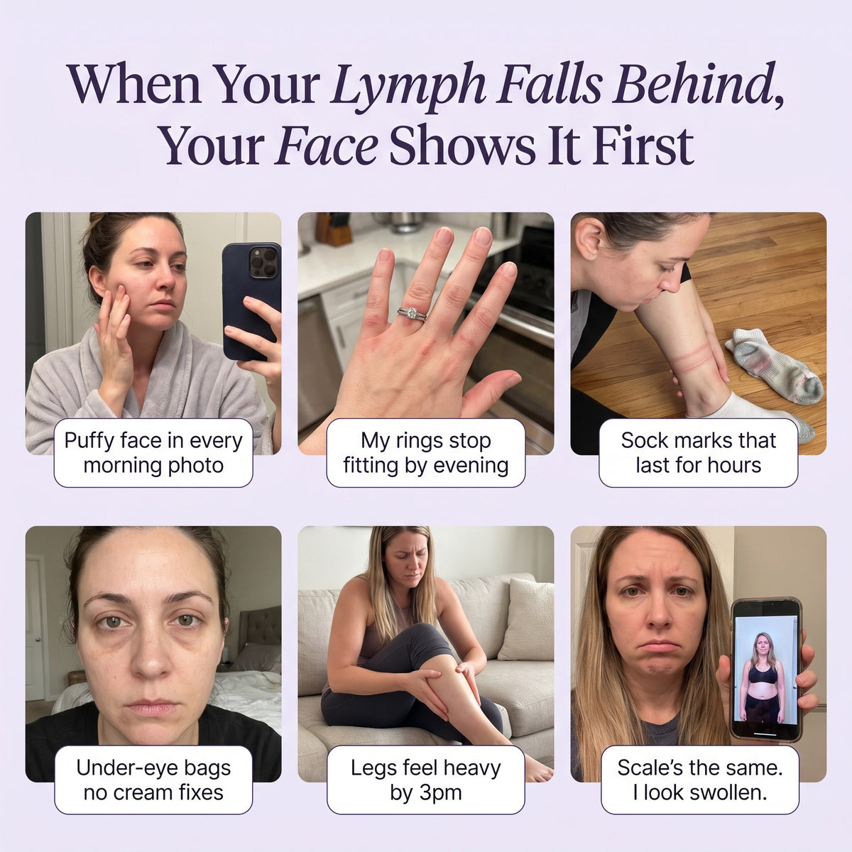 Lymph Flow gallery — when your lymph falls behind