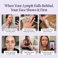 Lymph Flow gallery — when your lymph falls behind