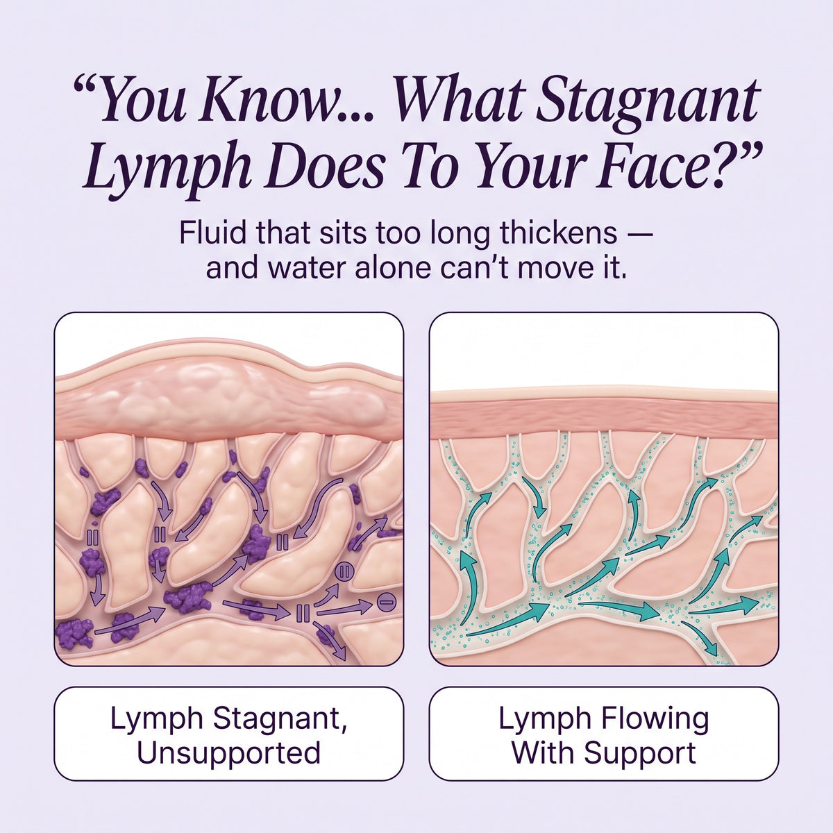 Lymph Flow gallery — stagnant vs flowing diagram