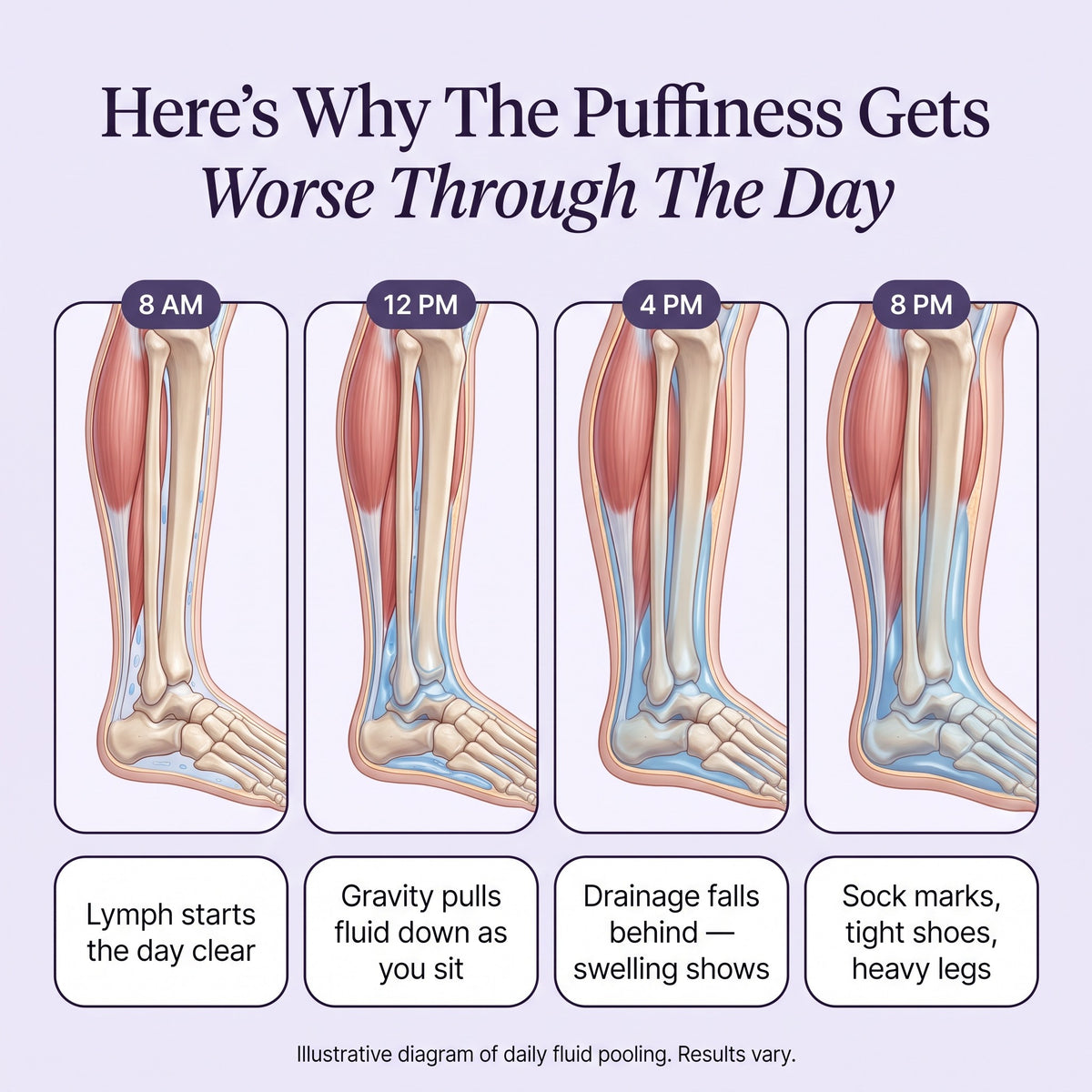 Lymph Flow gallery — illustrative daily pooling timeline